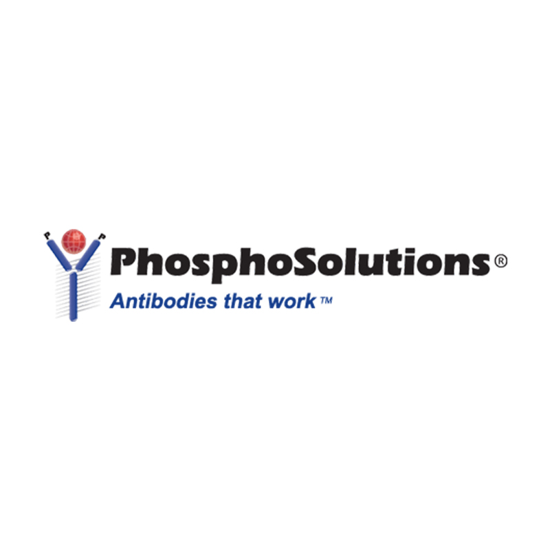 Troponin I (cardiac) Ser150