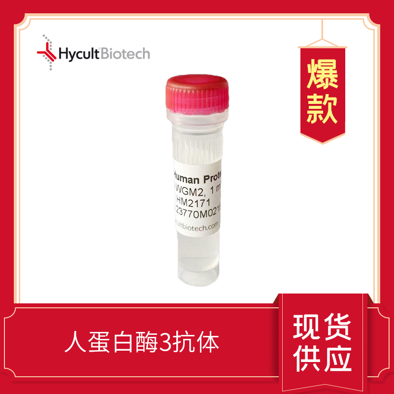 Human Proteinase 3 mAb WGM2